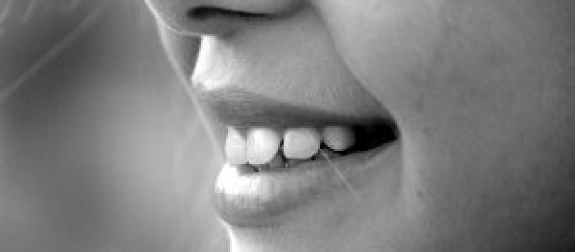 הלבנת-שיניים-–-כל-מה-שחשוב-לדעת.jpg